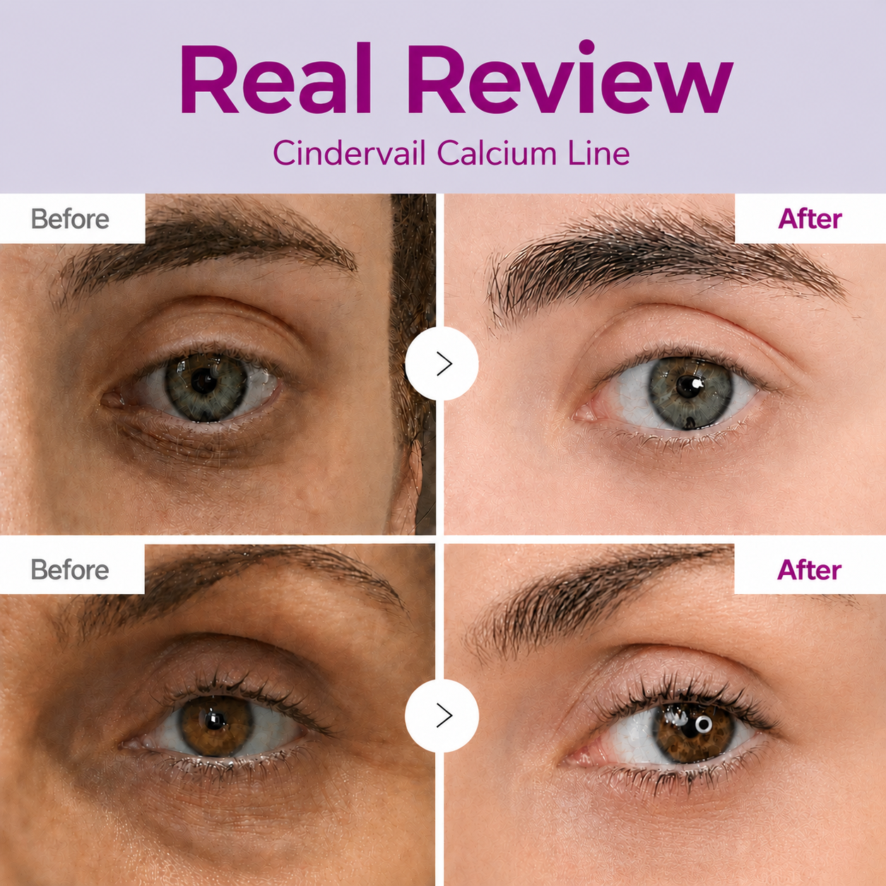 🔥LAST DAY 60% OFF!!Cindervail Korean Calcium Dark Spot Eye Cream