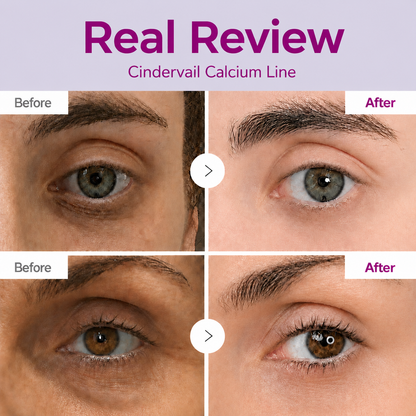 🔥LAST DAY 60% OFF!!Cindervail Korean Calcium Dark Spot Eye Cream